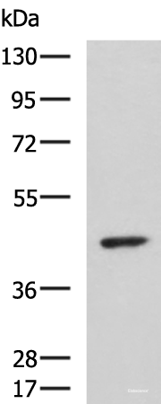 Western blot analysis of Hela cell lysate  using ARPC1B Polyclonal Antibody at dilution of 1:1000