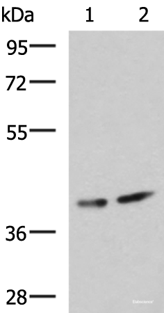 Western blot analysis of Human cerebrum tissue and Mouse brain tissue lysates  using PROKR2 Polyclonal Antibody at dilution of 1:800