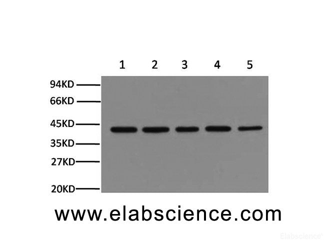 Western Blot analysis of Hela, Rat brain, Mouse brain, Chicken lung, Rabbit testis using beta actin Monoclonal Antibody at dilution of 1:5000.
