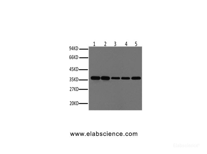 Western Blot analysis of Hela, Rat brain, Rabbit muscle, Sheep muscle, Mouse brain using GAPDH Monoclonal Antibody at dilution of 1:1000.