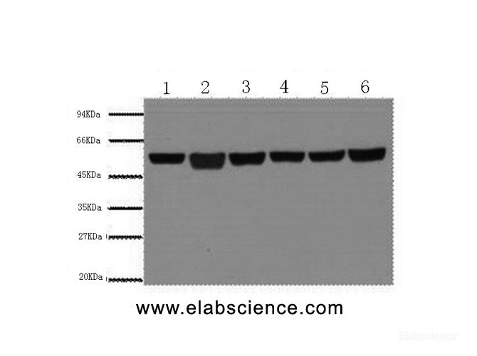 Western Blot analysis of A549, Rat brain, Mouse brain, Chicken lung, Rabbit testis, Sheep muscle using beta Tubulin Monoclonal Antibody at dilution of 1:5000.