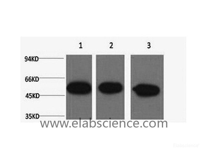 Western Blot analysis of 1) Hela, 2) Mouse brain, 3) Rat brain using beta Tubulin Monoclonal Antibody at dilution of 1:5000.