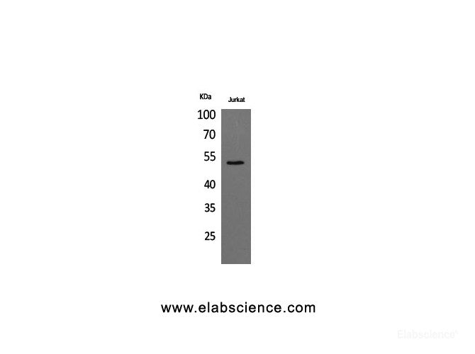 Western Blot analysis of Jurkat cells using alpha Tubulin Polyclonal Antibody at dilution of 1:1000.