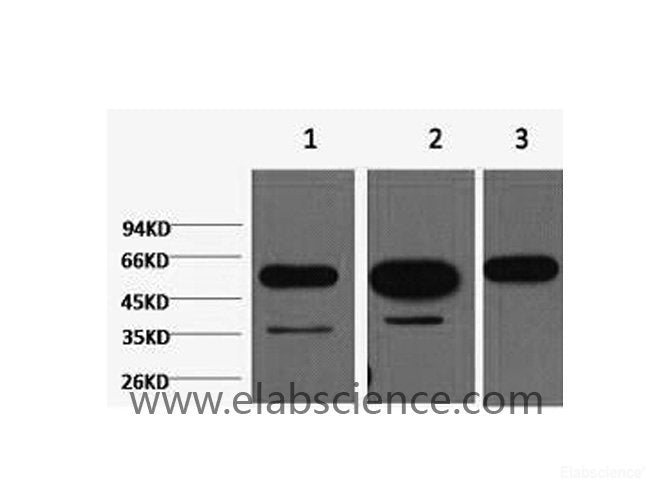 Western Blot analysis of 1) Hela, 2) Mouse brain, 3) Rat brain using beta Tubulin Monoclonal Antibody at dilution of 1:5000.