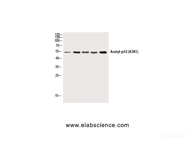 Western Blot analysis of HepG2, 293T-UV, Hela, AD293T, Hela-UV cells using p53 (Acetyl Lys381) Polyclonal Antibody at dilution of 1:1000.