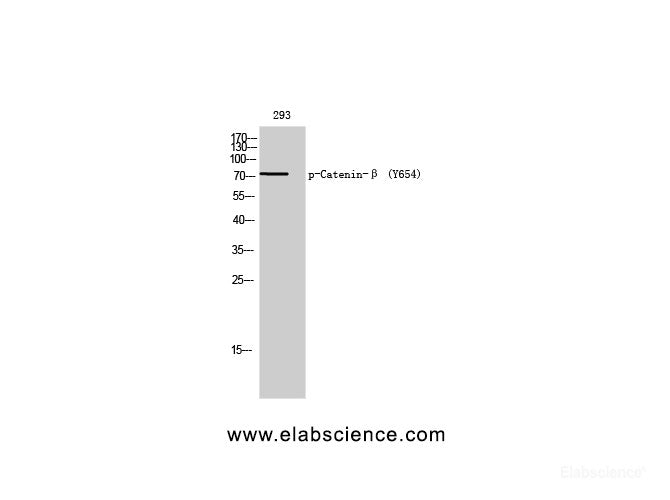 Western Blot analysis of 293T cells with Phospho-Catenin beta (Tyr654) Polyclonal Antibody