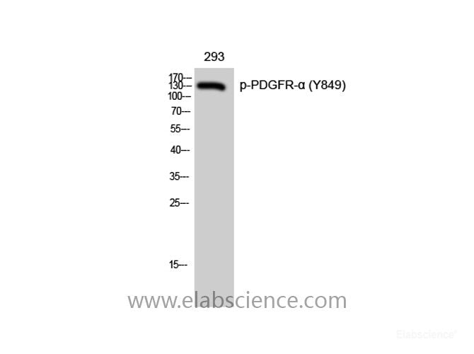 Western Blot analysis of 293 cells with Phospho-PDGFRA (Tyr849) Polyclonal Antibody