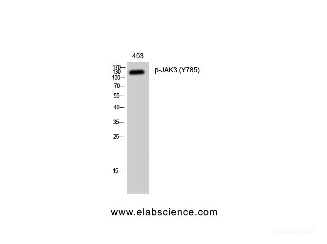Western Blot analysis of 453 cells with Phospho-JAK3 (Tyr785) Polyclonal Antibody at dilution of 1:1000