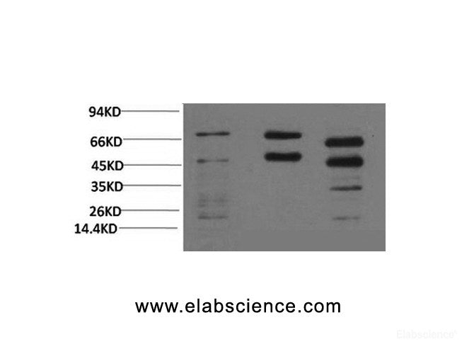 Western Blot analysis of 1) Hela, 2) Rat brain, 3) Mouse brain with Phosphoserine Monoclonal Antibody at dilution of 1:2000