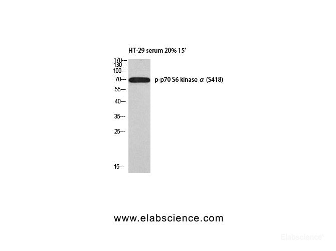 Western Blot analysis of HT-29 serum 20% 15' cells using Phospho-p70 S6 kinase alpha (Ser418) Polyclonal Antibody at dilution of 1:1000