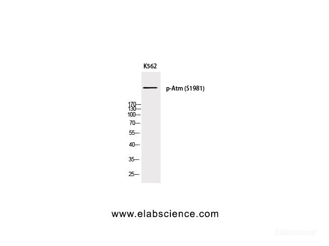 Western Blot analysis of K562 cells with Phospho-Atm (Ser1981) Polyclonal Antibody at dilution of 1:500