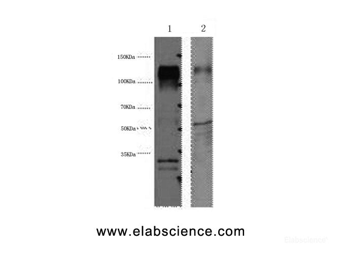 Western Blot analysis of 1) Hela, 2) Mouse brain using ERBB2 Monoclonal Antibody at dilution of 1:4000.