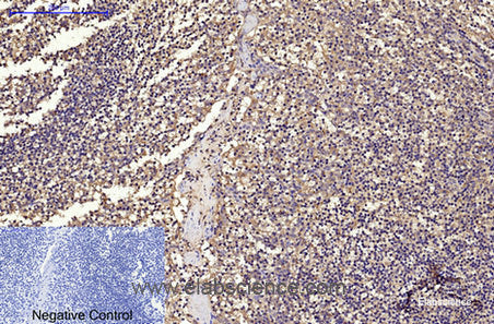 Immunohistochemistry of paraffin-embedded Human tonsil tissue using CD68 Monoclonal Antibody at dilution of 1:200.