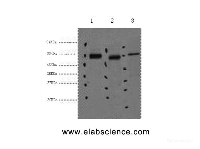 Western Blot analysis of 1) Hela, 2) Mouse kidney, 3) Mouse brain using CK-7 Monoclonal Antibody at dilution of 1:2000.