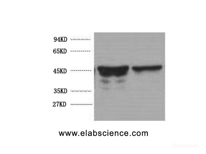 Western Blot analysis of Rat brain using GFAP Monoclonal Antibody at dilution of 1:5000.