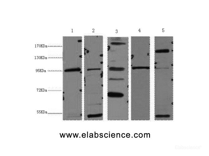 Western Blot analysis of 1) Hela, 2) 293T, 3) MCF7, 4) Mouse brain, 5) Rat liver using Catenin beta Monoclonal Antibody at dilution of 1:2000.