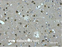 Immunohistochemistry of paraffin-embedded Human brain tissue using MAP2 Monoclonal Antibody at dilution of 1:200.
