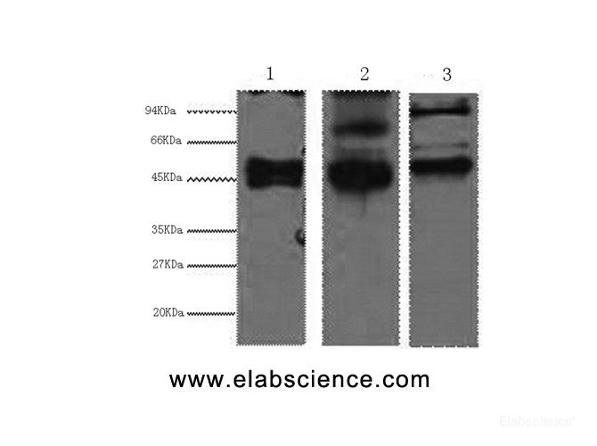 Western Blot analysis of 1) Hela, 2) MCF7, 3) 293T cells using CK-17 Monoclonal Antibody at dilution of 1:2000.