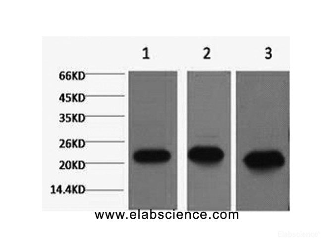 Western Blot analysis of 1) MCF7, 2) Rat kidney, 3) Mouse brain using PRDX1 Monoclonal Antibody at dilution of 1:2000.