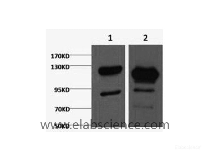 Western Blot analysis of 1) Jurkat, 2) Hela cells using Cleaved PARP1 Monoclonal Antibody at dilution of 1:2000.