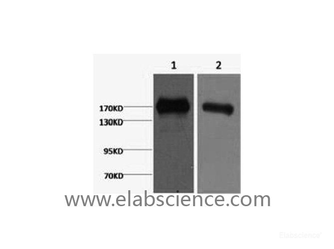 Western Blot analysis of 1) A431, 2) Hela cells using EGFR Monoclonal Antibody at dilution of 1:2000.