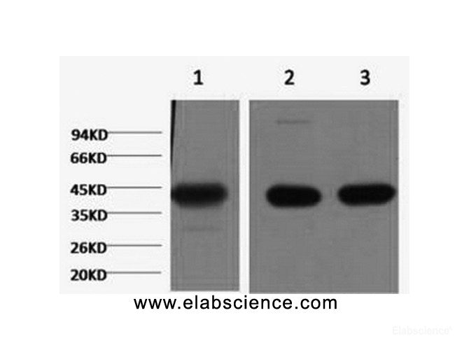 Western Blot analysis of 1) Hela, 2) Mouse brain, 3) Rat brain using ACTA1 Monoclonal Antibody at dilution of 1:1000.