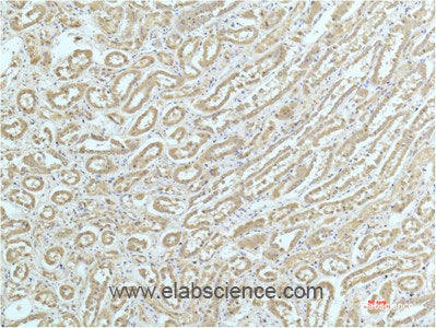 Immunohistochemistry of paraffin-embedded Human kidney tissue using ACTN1 Monoclonal Antibody at dilution of 1:200.