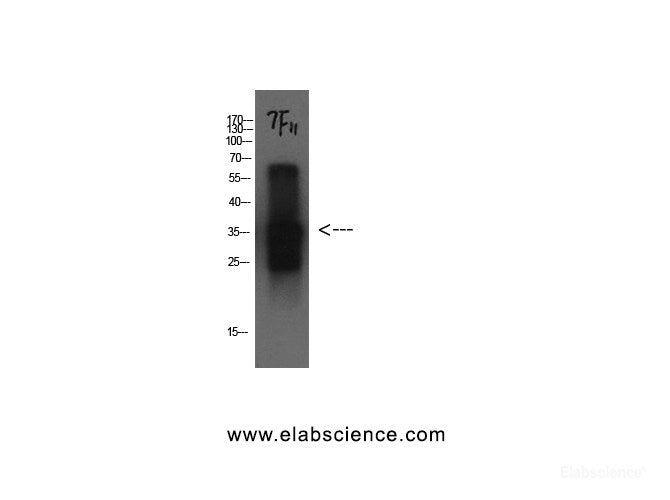 Western Blot analysis of Cystatin C protein using CST3 Monoclonal Antibody at dilution of 1:1000.