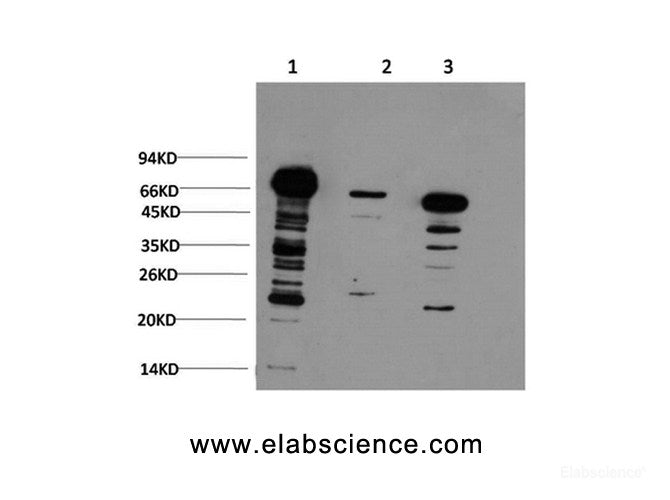 Western Blot analysis of 1) Hela, 2) 3T3, 3) Rat brain using Ubiquitin Monoclonal Antibody at dilution of 1:1000.