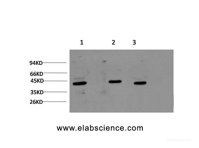 Western Blot analysis of 1) Hela, 2) 3T3, 3) Rat brain using ACTA1 Monoclonal Antibody at dilution of 1:1000.