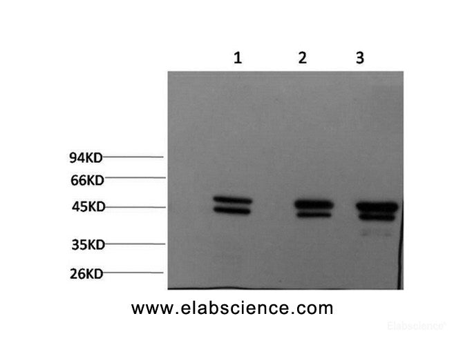 Western Blot analysis of 1) MCF7, 2) Rat brain, 3) Mouse brain using Epsilon Tubulin Monoclonal Antibody at dilution of 1:2000.