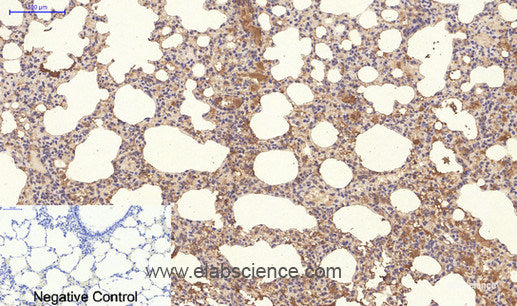 Immunohistochemistry of paraffin-embedded Rat lung tissue using NBR1 Monoclonal Antibody at dilution of 1:200.