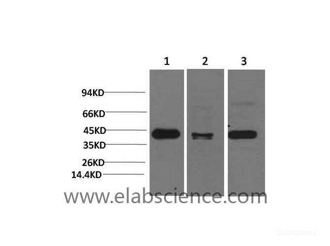 Western Blot analysis of 1) Hela, 2) Mouse brain, 3) Rat brain using TBP Monoclonal Antibody at dilution of 1:2000.