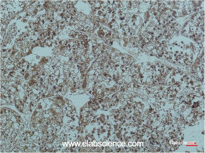 Immunohistochemistry of paraffin-embedded Human Liver tissue using Smad3 Monoclonal Antibody at dilution of 1:200.