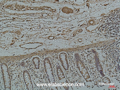Immunohistochemistry of paraffin-embedded Human colon using Galectin 3 Monoclonal Antibody at dilution of 1:50.