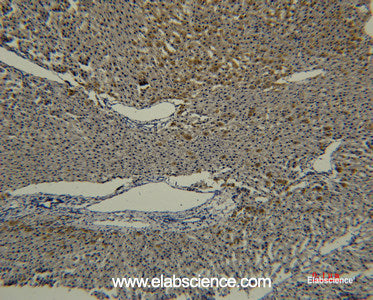 Immunohistochemistry of paraffin-embedded Rat liver tissue using Transferrin Monoclonal Antibody at dilution of 1:50.