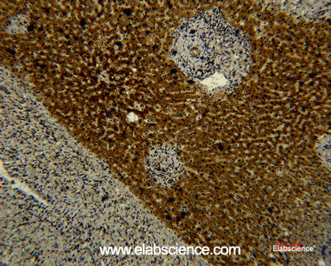 Immunohistochemistry of paraffin-embedded Human liver tissue using Transferrin Monoclonal Antibody at dilution of 1:50.