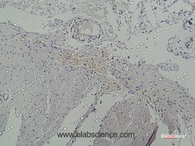 Immunohistochemistry of paraffin-embedded Human colon using Galectin 3 Monoclonal Antibody at dilution of 1:50.