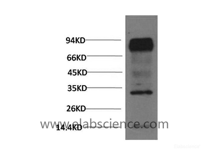 Western Blot analysis of Mouse brain using HIF1 bata Monoclonal Antibody at dilution of 1:2000.