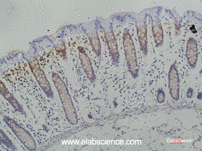 Immunohistochemistry of paraffin-embedded Human colon using Galectin 3 Monoclonal Antibody at dilution of 1:50.