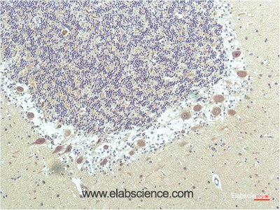 Immunohistochemistry of paraffin-embedded Human brain tissue using PPARD Monoclonal Antibody at dilution of 1:200.