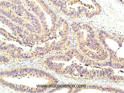 Immunohistochemistry of paraffin-embedded Human colon tissue using STAT1 Monoclonal Antibody at dilution of 1:200.