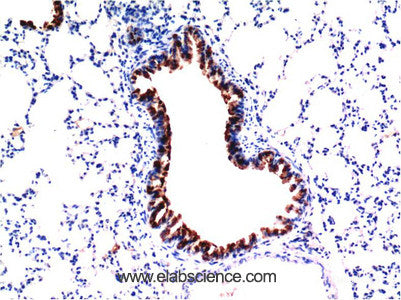 Immunohistochemistry of paraffin-embedded Mouse liver tissue using TGFB1 Monoclonal Antibody at dilution of 1:200.