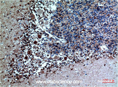 Immunohistochemistry of paraffin-embedded Human brain tissue using CST3 Monoclonal Antibody at dilution of 1:200.
