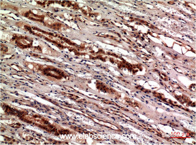 Immunohistochemistry of paraffin-embedded Human kidney tissue using CST3 Monoclonal Antibody at dilution of 1:200.