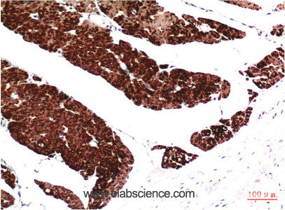 Immunohistochemistry of paraffin-embedded Human colon carcinoma tissue using ACTA1 Monoclonal Antibody at dilution of 1:200.