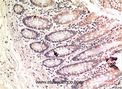Immunohistochemistry of paraffin-embedded Human colon carcinoma tissue using gamma Tubulin Monoclonal Antibody at dilution of 1:200.