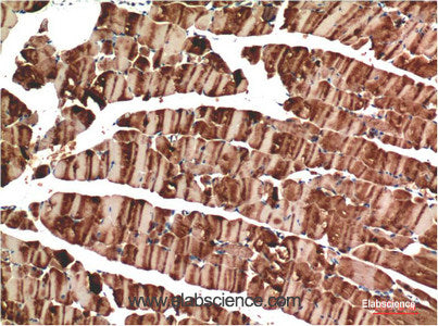 Immunohistochemistry of paraffin-embedded Mouse skeletal muscle tissue using ACTA1 Monoclonal Antibody at dilution of 1:200.