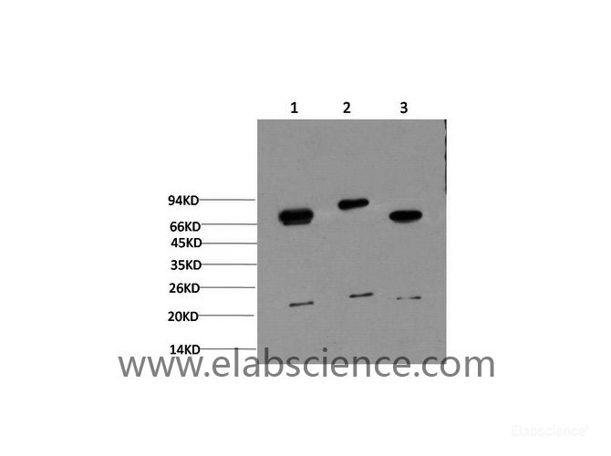 Western Blot analysis of 1) Hela, 2) 3T3, 3) Rat brain using Ubiquitin Monoclonal Antibody at dilution of 1:1000.