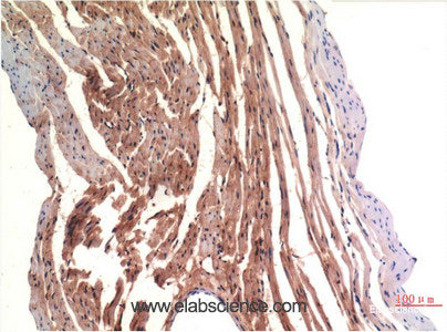 Immunohistochemistry of paraffin-embedded Rat heart tissue using VE-Cadherin Monoclonal Antibody at dilution of 1:200.